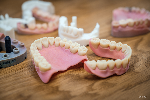 3D nyomtatott fogsor modellek a Dentalklinik-nél